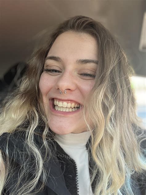 I GOT MY BRACES OFF!!! : r/HeidiLavon